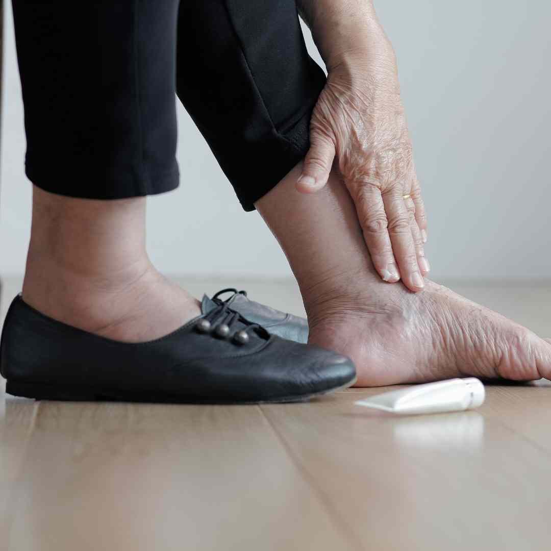 A close up view of an elderly woman's feet. They are a bit swollen. One has a shoe on, the other is bare. She is applying lotion to the exposed foot.